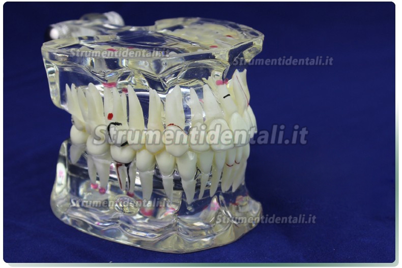 ENOVO Modello malattie dentali demo